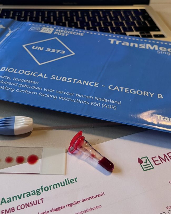 EMB bloedtest
